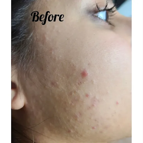 Luminous Skin & Laser Clinic