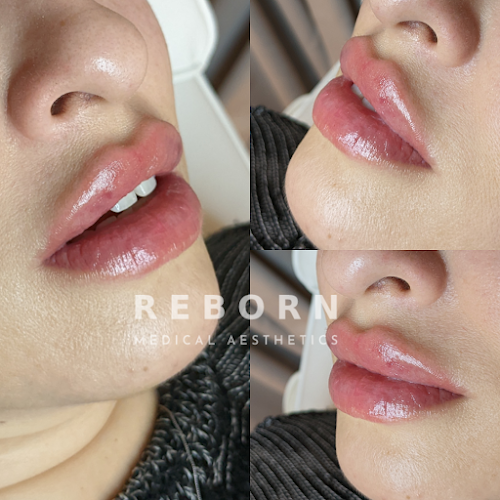 Reborn Medical Aesthetics